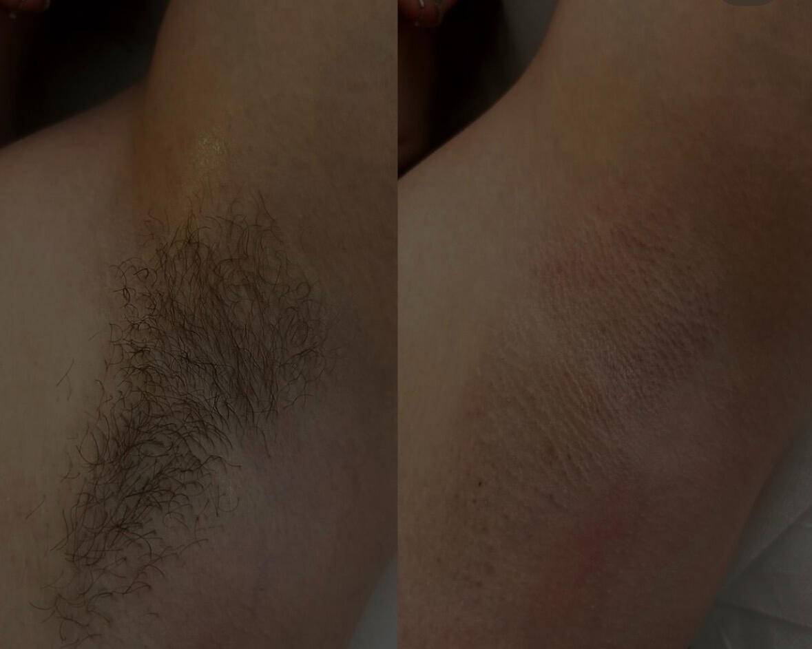 waxing
